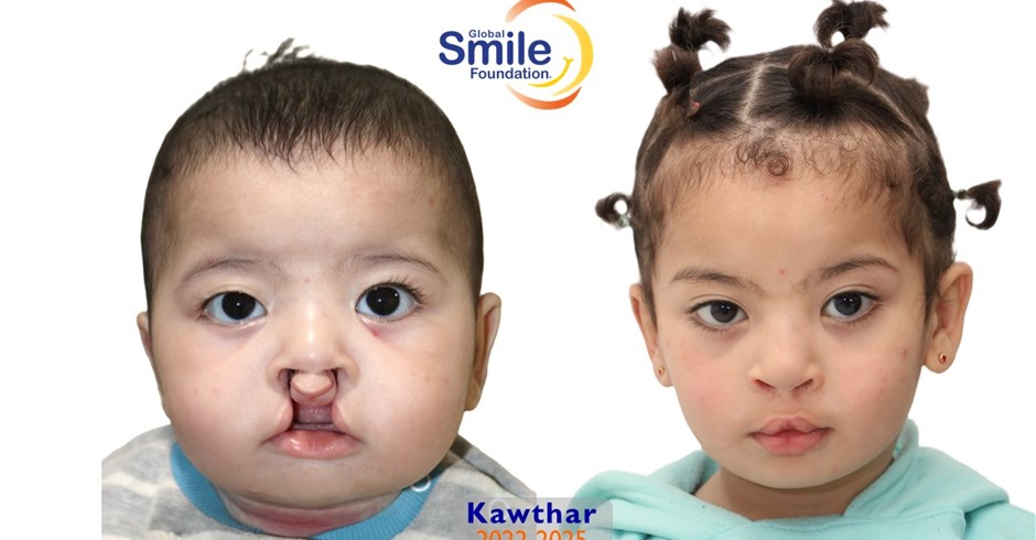 Global Smile Foundation MENA